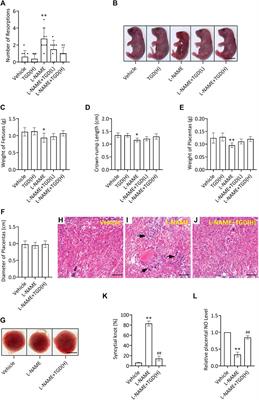 Tianma Gouteng Decoction Exerts Pregnancy-Protective Effects Against Preeclampsia via Regulation of Oxidative Stress and NO Signaling